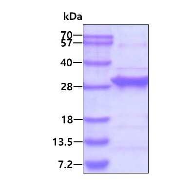 SDS-PAGE: Recombinant Human RGS4 His Protein [NBP1-72404]